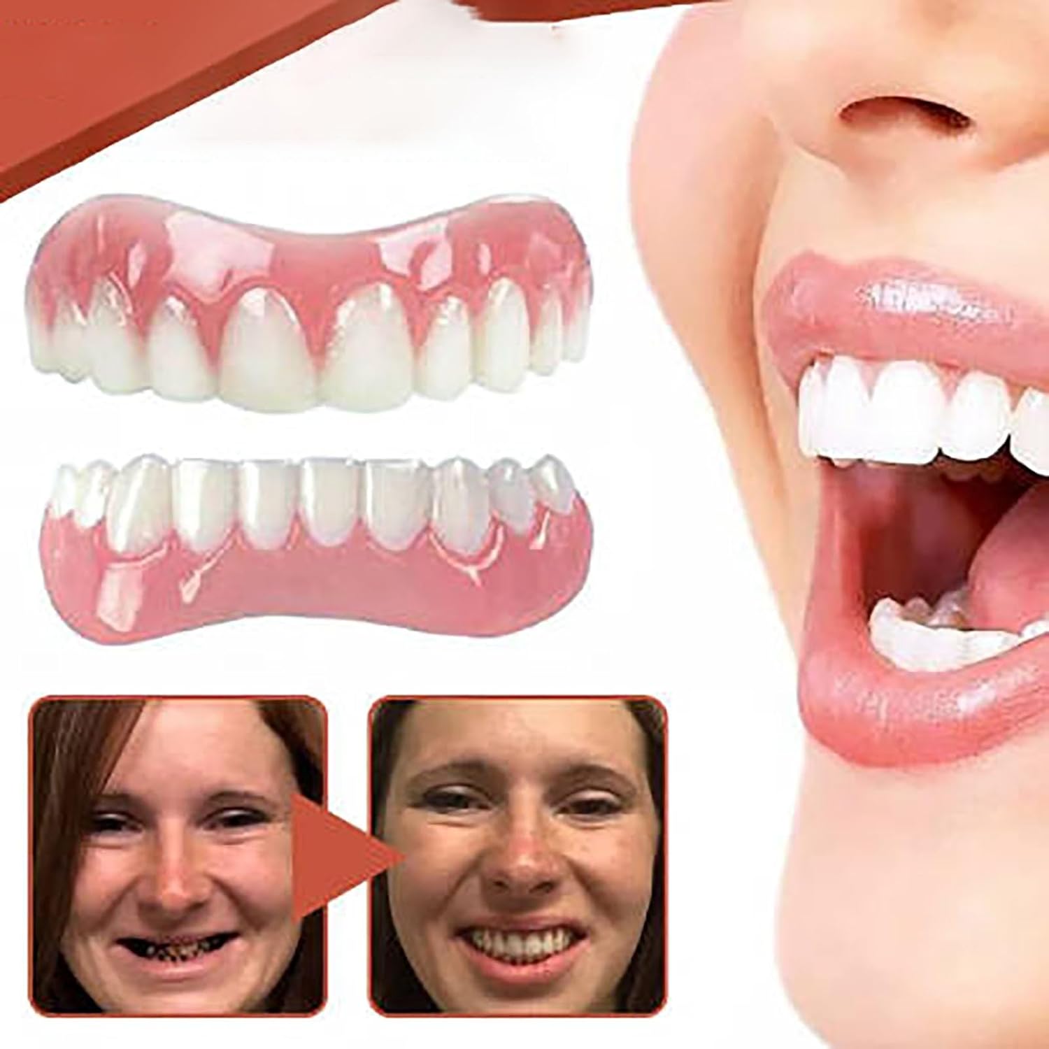 Denture Silicone Reline Kit Upper and Lower Set C610282