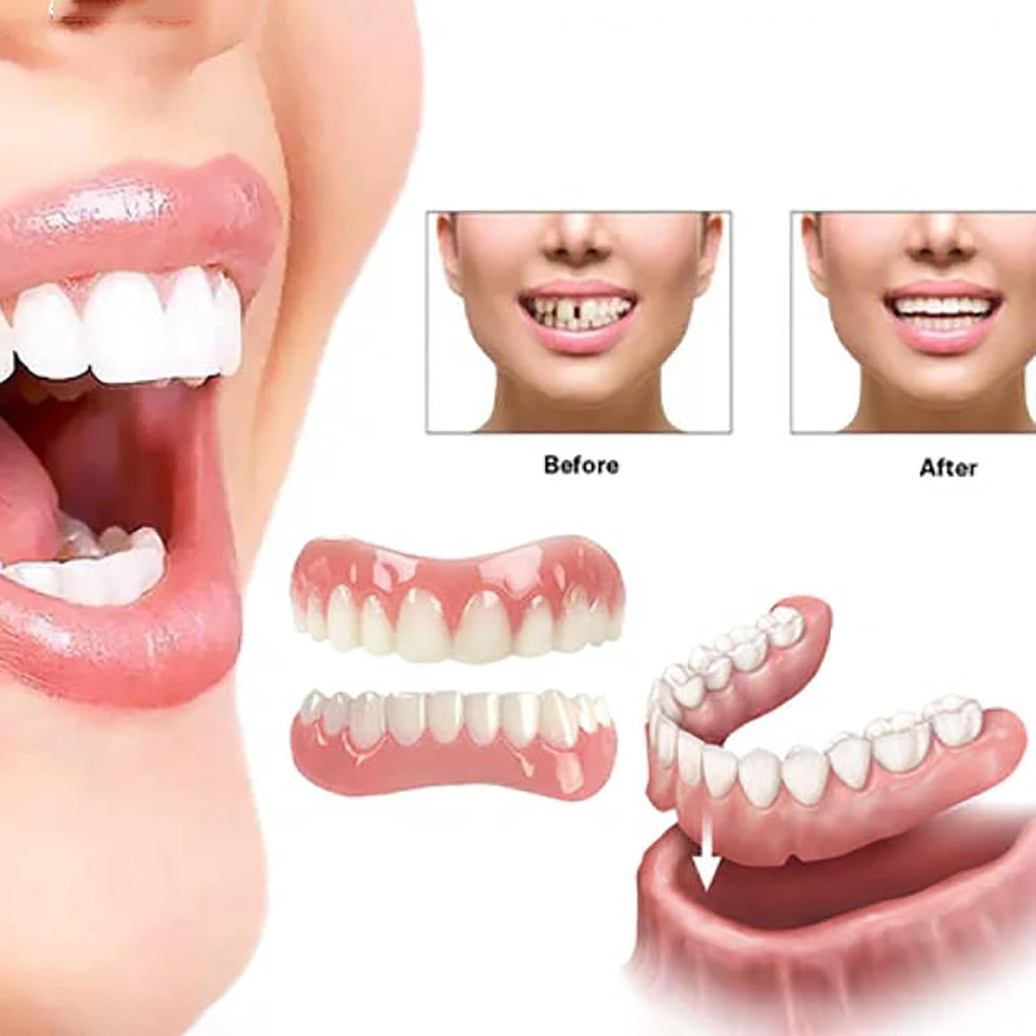 Denture Silicone Reline Kit Upper and Lower Set C610282